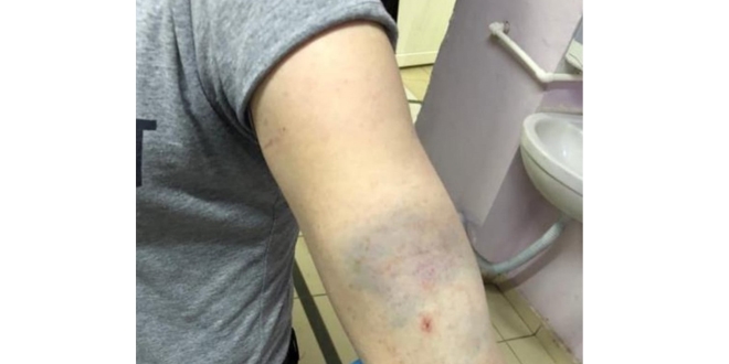 Ordu'da doktor ve sağlık çalışanlarına darp