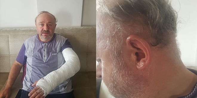 Nacakla saldırıya uğrayan muhtar kolundan yaralandı