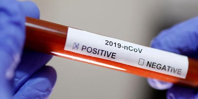 Bir milletvekilinin daha Kovid-19 testi pozitif çıktı