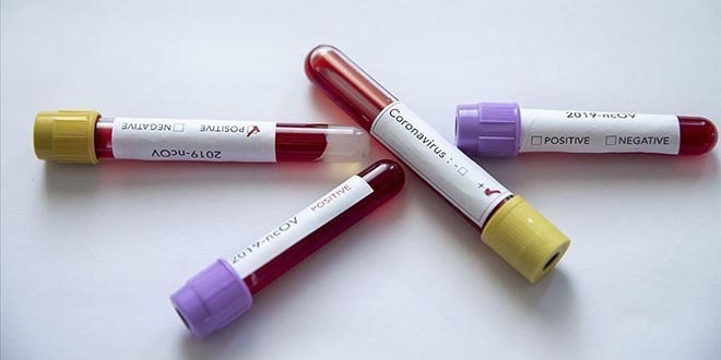 Bu ilde koronavirüsten dolayı 3 kişi hayatını kaybetti