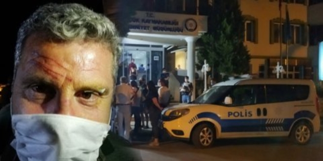 CHP'li meclis üyesinin darbedildiği iddiasına suç duyurusu