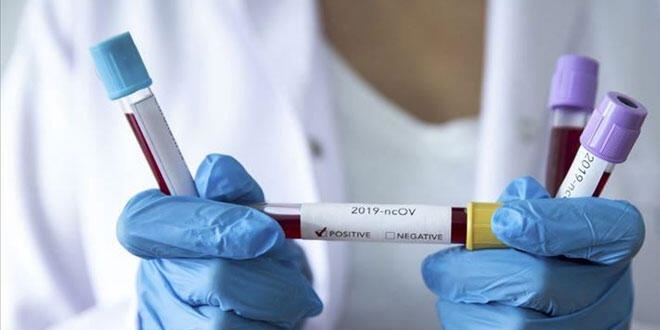Türkiye'nin koronavirüsle mücadelesinde son 24 saatte yaşananlar
