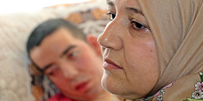 6,5 yıldır gözlerini kırpamıyor, annesi uyuduğunu horlayınca anlıyor