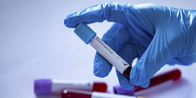 Dünya genelinde Kovid-19 tespit edilen kişi sayısı 37 milyon 475 bini geçti