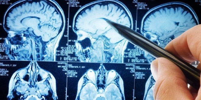 Bilim insanları, kafatasında yeni bir organ buldu