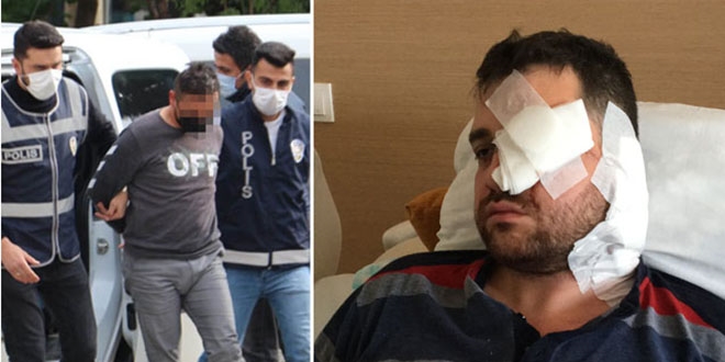 Avukatı kör eden peruklu saldırgan tutuklandı