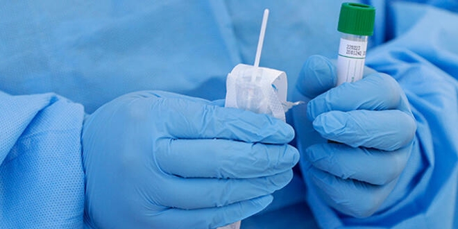 Özelde test ücreti 250 TL olacak
