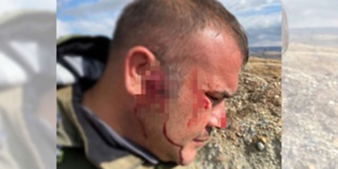 Kaçak avcılar, şehit kardeşi av koruma memurunu darbetti