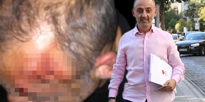 Ünlü restoranın sahibine polis dayağı iddiası