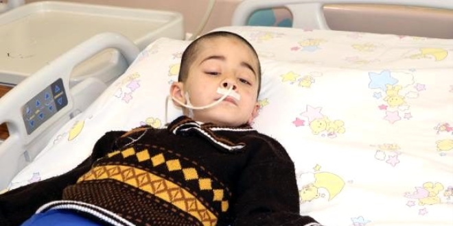 Balkondan düştü, görme yetisini kaybetti