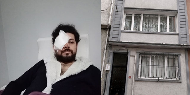 Şarkıcı, evinin penceresinde gözünden vuruldu