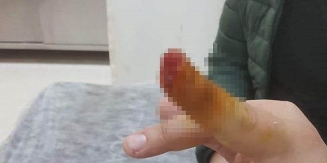 Tartıştığı güvenlik görevlisinin parmağını ısırıp, kopardı
