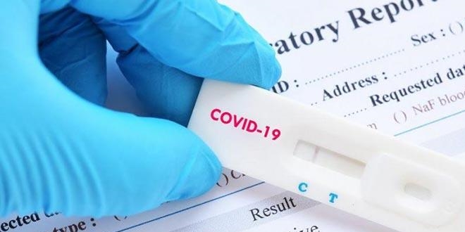 Medipol niversitesinden 'PCR testi creti' aklamas