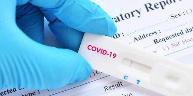 Medipol Üniversitesinden 'PCR testi ücreti' açıklaması
