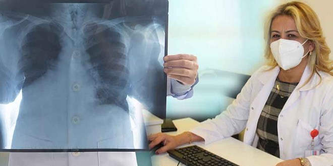Bilim Kurulu Üyesi: Koronanın akciğerde yaptığı hasar inanılmaz