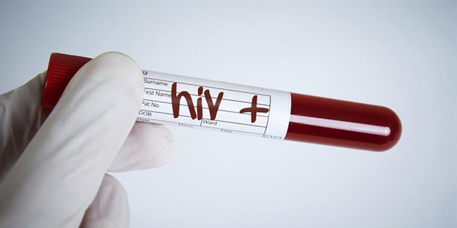 26 bin kişi HIV pozitif