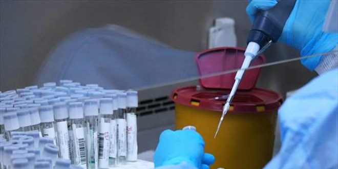 Samsun'da koronavirüs test cihazı ve kapasitesi artırıldı