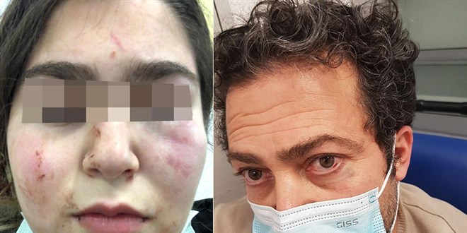 Almanya'da polis 17 yaşındaki Türk kızını ve babasını hastanelik etti