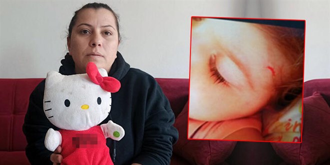 Kreşte şiddeti, oyuncağa yerleştirilen ses kayıt cihazı ortaya çıktı