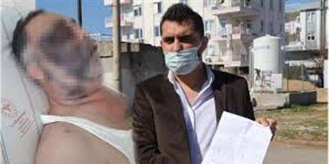 Baba ve oğlu tarafından darbedildiği öne sürülen engelli öldü