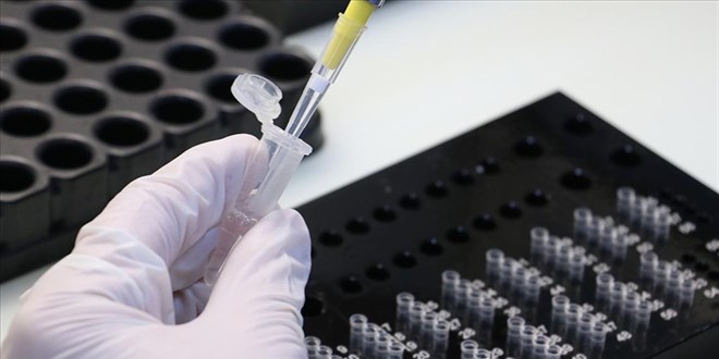 'Uzman personel' test sonuçları için zamanla yarışıyor