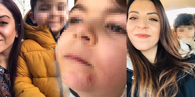 Diş Hekiminden 5 yaşındaki çocuk hastasına darp