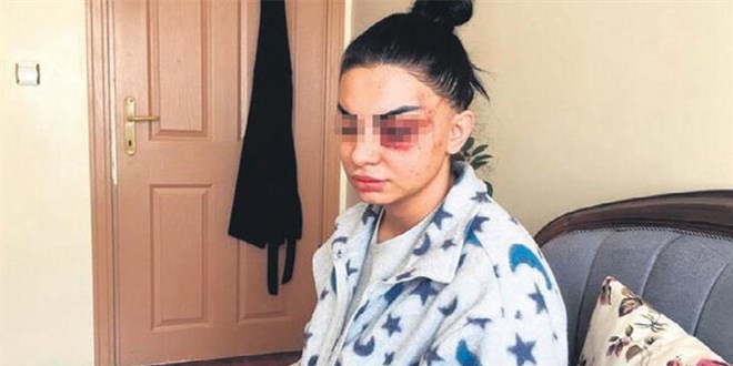 Eşinden şiddet gören hemşire tek tek anlattı: 41 günlük kabus