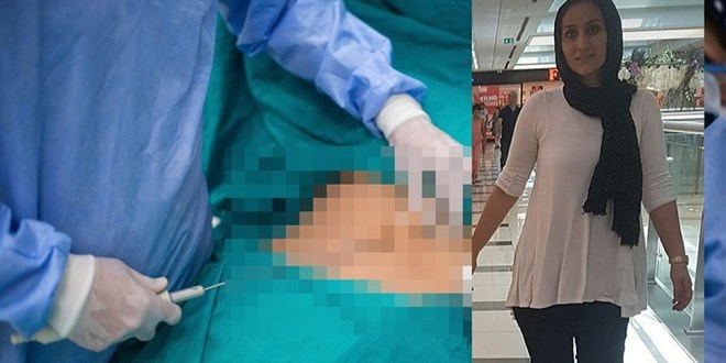 Ameliyat skandalı! İçinde unuttular, 6 yıl öyle yaşadı