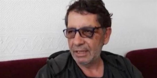 Gazeteci Demira'a ynelik saldryla ilgili iddianame hazrland
