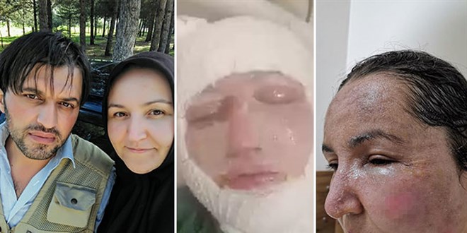 Çocuklarının gözü önünde eşini kızgın yağ ve kaynar su ile haşladı