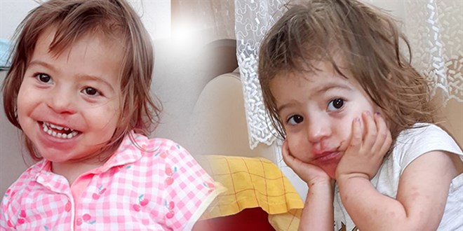 Doktorların 3 ay ömür biçtiği minik Hira'dan acı haber