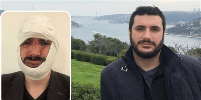 Trafikte tartıştıkları AA muhabirinin çenesini kıran şüpheliler tutuklandı