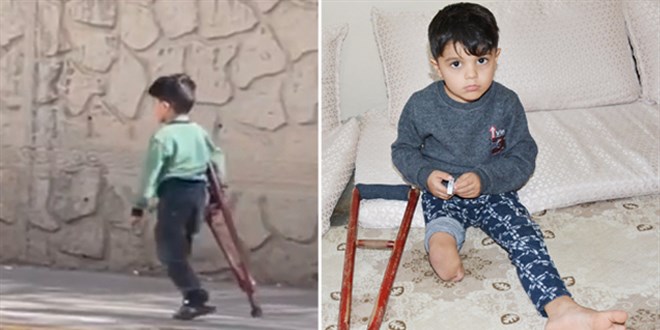 3 yaşındaki Muhammet için protez bacak siparişi verildi