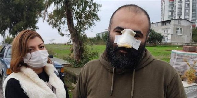 'Bir şey yapmaz' denilen pitbull, burnunu kopardı
