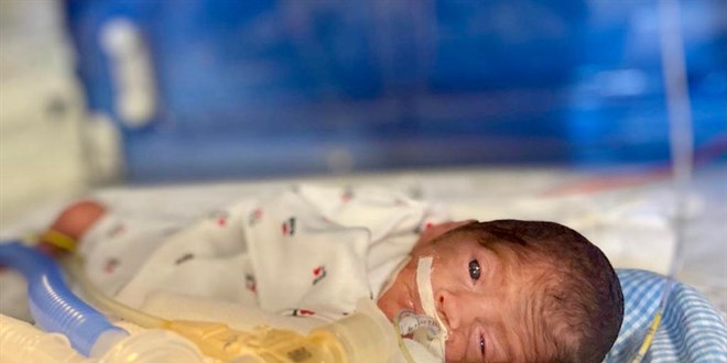 648 gram doğan Umut bebek hayata tutunmayı başardı
