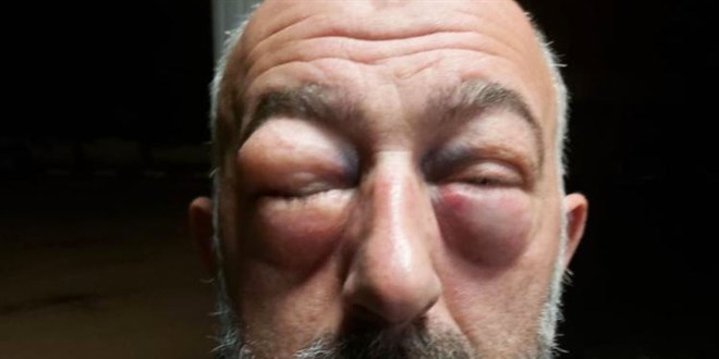 'Şerefsiz' dediği şoför diğer şoförün babası çıkınca vatandaş dayak yedi