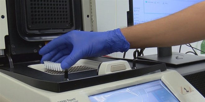 Doğruluk oranı yüzde 100'e yakın yeni PCR tanı kiti yolda