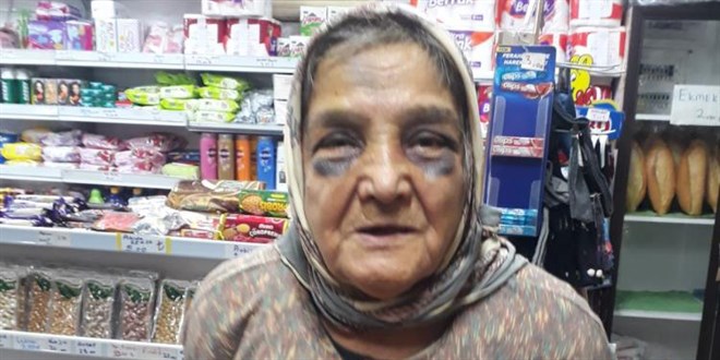Demir çubukla dövdüğü 73 yaşındaki eşini, bakın ne hale soktu