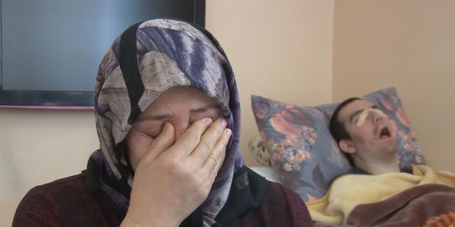 SSPE hastalığına yakalandı: 8 yıldır gözlerini kapatamıyor