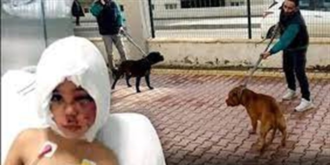 Pitbull saldırısının güvenlik kamerası kayıtları silinmeye çalışılmış
