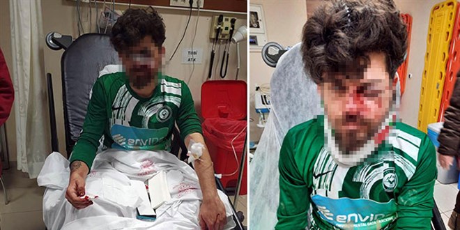 Kırmızı kart gören futbolcu, yerde yatan rakibinin yüzüne tekme attı