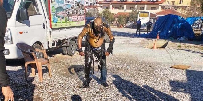Zabıtaya kızıp kendini yakan seyyar satıcı hayatını kaybetti