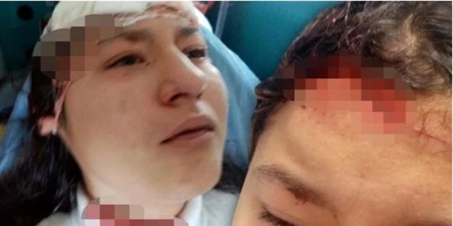 14 yaşındaki çocuğa selfie çekerken 5 köpek saldırdı
