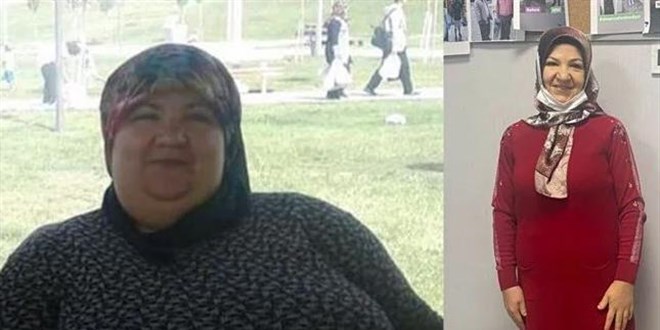 2 yılda 95 kilo verdi: Çorabımı bile giyemiyordum