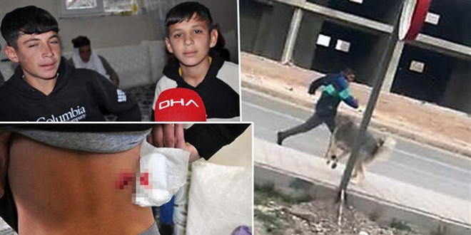 4'ü çocuk 7 kişi köpeklerin saldırısına uğradı! O anlar kamerada
