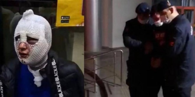 Kız arkadaşının yüzüne kızgın yağ döken zanlıya yakalama kararı