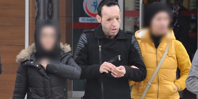 Yüz nakli yapılan Recep Sert gözaltına alındı