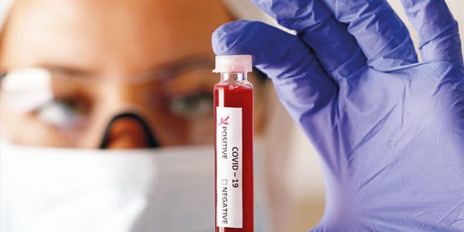 Bir lke karar ald: Kovid-19'a grip muamelesi yapacak