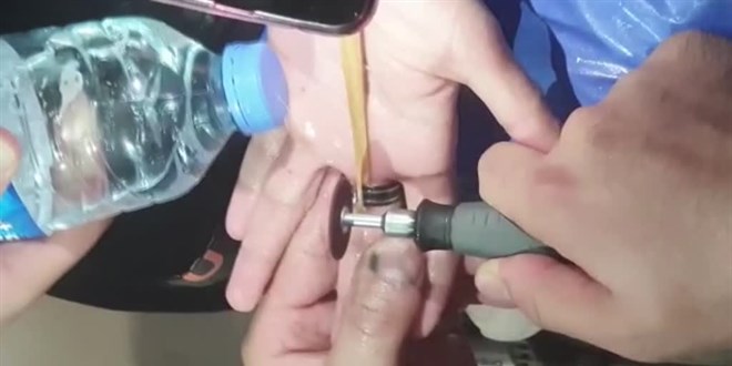 Sivas'ta bir kişinin parmağına sıkışan yüzüğü itfaiye çıkardı
