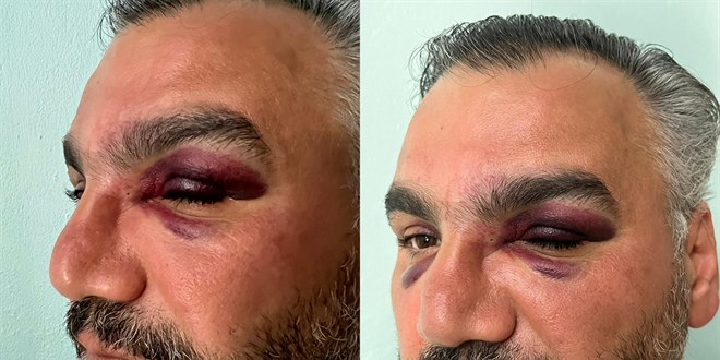 Eşinin memleketini tanımak isteyen gurbetçi, trafik magandalarının hedefi oldu